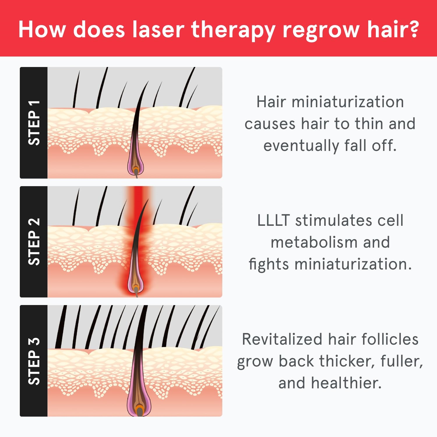 Best Laser Helmet for Hair Loss 2026